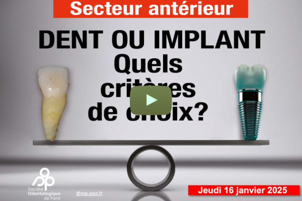 Replay Journée « Secteur antérieur : dent ou implant »